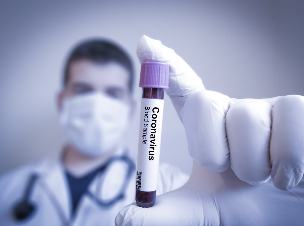 Coronavirüsü hakkında bilmeniz gereken her şey